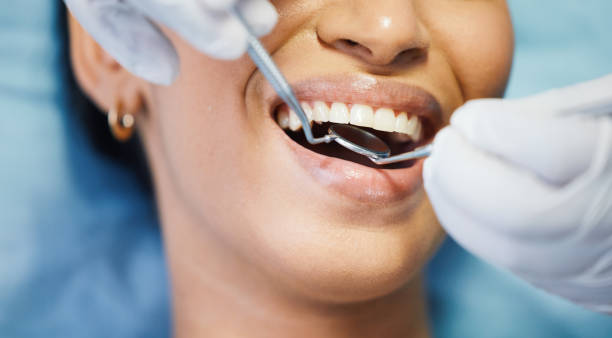 Best Broken or Chipped Tooth Repair in Penrose, CO